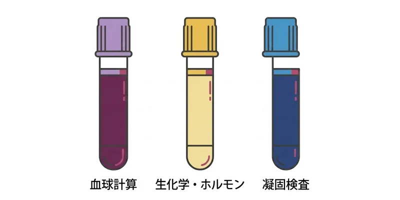 3種類の採血管比較：紫管（血球計算）、黄管（生化学）、青管（凝固）