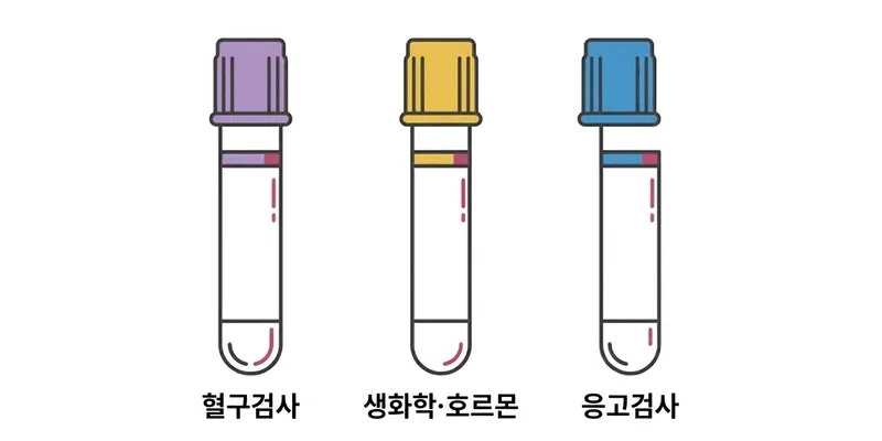 3가지 채혈관 비교: 보라관(혈구), 노란관(생화학), 파란관(응고)