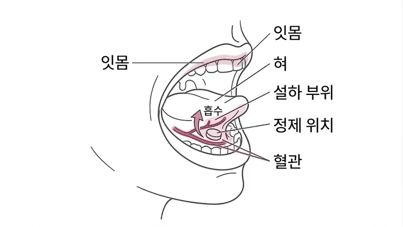 설하 투여 위치도: 정제를 혀 아래 잇몸 근처에 놓고 설하 점막 혈관으로 흡수