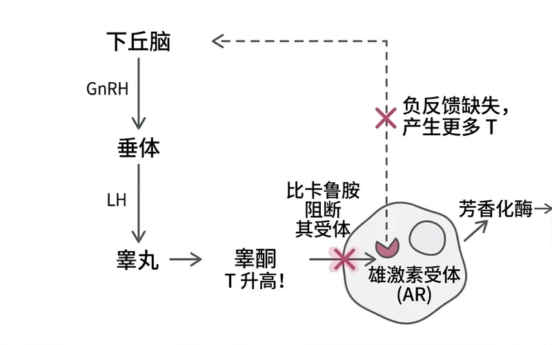 比卡鲁胺机制图：阻断雄激素受体但因负反馈缺失导致睾酮反而升高